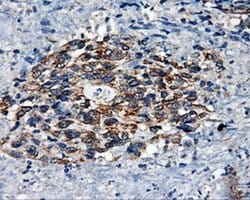 SRR Monoclonal Antibody (OTI1D7), TrueMAB , OriGene 100 &mu;L; Unconjugated:Antibodies,