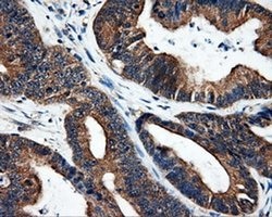 SRR Monoclonal Antibody (OTI1D7), TrueMAB , OriGene 100 &mu;L; Unconjugated:Antibodies,