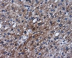 SRR Monoclonal Antibody (OTI1D7), TrueMAB , OriGene 100 &mu;L; Unconjugated:Antibodies,