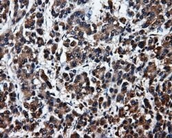 SRR Monoclonal Antibody (OTI1D7), TrueMAB , OriGene 100 &mu;L; Unconjugated:Antibodies,