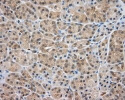 SRR Monoclonal Antibody (OTI3B5), TrueMAB , OriGene 100 &mu;L; Unconjugated:Antibodies,
