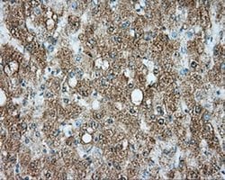 SRR Monoclonal Antibody (OTI3B5), TrueMAB , OriGene 100 &mu;L; Unconjugated:Antibodies,