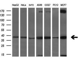 SRR Monoclonal Antibody (OTI9E8), TrueMAB , OriGene 30 &mu;L | Buy Online | OriGene | Fisher Scientific