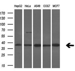 SRR Monoclonal Antibody (OTI7E8), TrueMAB , OriGene 100 &mu;L; Unconjugated:Antibodies,