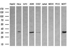 SRR Monoclonal Antibody (OTI3B5), TrueMAB , OriGene 100 &mu;L; Unconjugated:Antibodies,