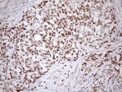 SRSF9 Monoclonal Antibody (OTI5A12), TrueMAB , OriGene 100 &mu;L; Unconjugated:Antibodies,