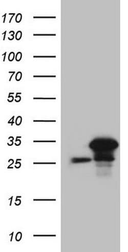SRSF9 Monoclonal Antibody (OTI5A12), TrueMAB , OriGene 100 &mu;L; Unconjugated:Antibodies,