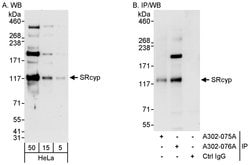SRcyp Rabbit anti-Human, Polyclonal, Bethyl Laboratories 100 &mu;L; Unconjugated:Antibodies,