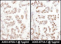 SRp75 Rabbit anti-Human, Polyclonal, Bethyl Laboratories 100 &mu;L; Unconjugated:Antibodies,
