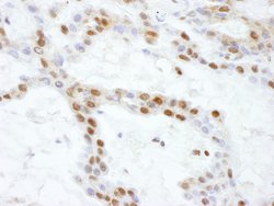 SS-B Rabbit anti-Human, Mouse, Polyclonal, Bethyl Laboratories 10 &mu;L | Buy Online | Bethyl Laboratories, Inc | Fisher Scientific