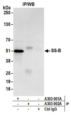SS-B Rabbit anti-Human, Mouse, Polyclonal, Bethyl Laboratories 10 &mu;L | Buy Online | Bethyl Laboratories, Inc | Fisher Scientific
