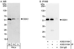 SSA1 Rabbit anti-Human, Polyclonal, Bethyl Laboratories 100 &mu;L; Unconjugated:Antibodies,