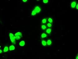 SSB Mouse anti-Canine, Human, Clone: OTI3H9, lyophilized, TrueMAB 100 &mu;g;