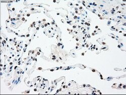 SSB Mouse anti-Canine, Human, Clone: OTI3H9, lyophilized, TrueMAB 100 &mu;g;