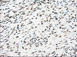 SSB Mouse anti-Canine, Human, Clone: OTI2C8, lyophilized, TrueMAB 100 &mu;g | Buy Online | Origene Technologies | Fisher Scientific