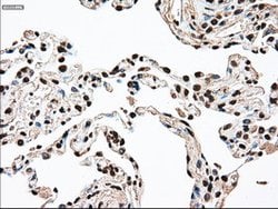 SSB Mouse anti-Canine, Human, Clone: OTI2C8, lyophilized, TrueMAB 100 &mu;g | Buy Online | Origene Technologies | Fisher Scientific