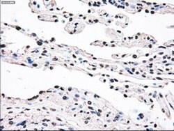 SSB Mouse anti-Canine, Human, Clone: OTI3F11, liquid, TrueMAB 100 &mu;L;