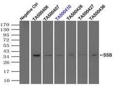 SSB Mouse anti-Canine, Human, Clone: OTI3H9, lyophilized, TrueMAB 100 &mu;g;