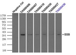 SSB Mouse anti-Canine, Human, Clone: OTI3F11, liquid, TrueMAB 100 &mu;L;