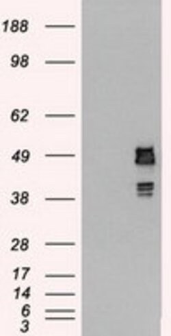SSB Mouse anti-Canine, Human, Clone: OTI2C8, lyophilized, TrueMAB 100 &mu;g | Buy Online | Origene Technologies | Fisher Scientific