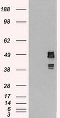 SSB Mouse anti-Canine, Human, Clone: OTI2C8, TrueMAB , Origene 30 &mu;L;