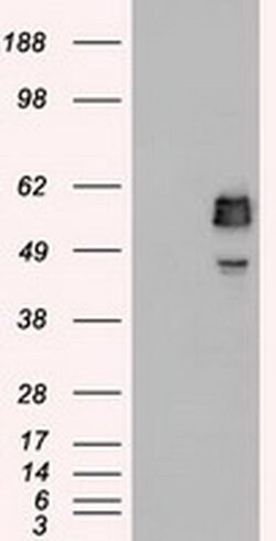 SSB Mouse anti-Canine, Human, Clone: OTI3F11, liquid, TrueMAB 100 &mu;L;