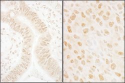 SSB1 Rabbit anti-Human, Mouse, Polyclonal, Bethyl Laboratories 100 &mu;L;
