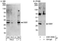SSB1 Rabbit anti-Human, Mouse, Polyclonal, Bethyl Laboratories 100 &mu;L;