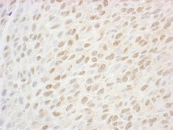 SSB1 Polyclonal Antibody, Bethyl Laboratories 100 &mu;L; Unconjugated:Antibodies,