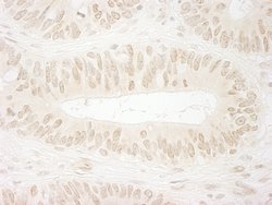 SSB1 Polyclonal Antibody, Bethyl Laboratories 100 &mu;L; Unconjugated:Antibodies,