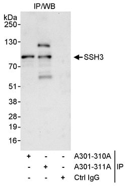 SSH3 Rabbit anti-Human, Polyclonal, Bethyl Laboratories 10 &mu;L; Unconjugated:Antibodies,
