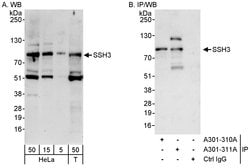 SSH3 Rabbit anti-Human, Polyclonal, Bethyl Laboratories 100 &mu;L; Unconjugated:Antibodies,