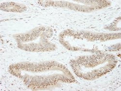 SSH3 Polyclonal Antibody, Bethyl Laboratories 10 &mu;L | Buy Online | Bethyl Laboratories, Inc | Fisher Scientific