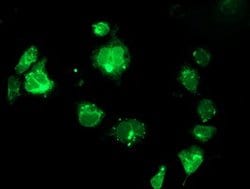 SSR1 Mouse anti-Human, Clone: OTI4H6, lyophilized, TrueMAB 100 &mu;g; Unconjugated:Antibodies,