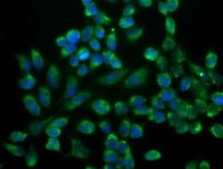 SSR1 Mouse anti-Human, Clone: OTI4H6, lyophilized, TrueMAB 100 &mu;g; Unconjugated:Antibodies,