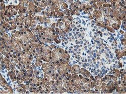 SSR1 Mouse anti-Human, Clone: OTI4H6, lyophilized, TrueMAB 100 &mu;g; Unconjugated:Antibodies,