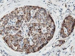 SSR1 Mouse anti-Human, Clone: OTI4H6, lyophilized, TrueMAB 100 &mu;g; Unconjugated:Antibodies,