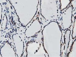 SSR1 Mouse anti-Human, Clone: OTI4H6, lyophilized, TrueMAB 100 &mu;g; Unconjugated:Antibodies,