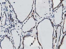 SSR1 Monoclonal Antibody (OTI4H6), TrueMAB , OriGene 100 &mu;L; Unconjugated:Antibodies,