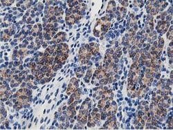 SSR1 Mouse anti-Human, Clone: OTI4H6, lyophilized, TrueMAB 100 &mu;g; Unconjugated:Antibodies,
