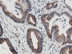 SSR1 Monoclonal Antibody (OTI4H6), TrueMAB , OriGene 100 &mu;L; Unconjugated:Antibodies,