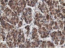 SSR1 Mouse anti-Human, Clone: OTI4H6, lyophilized, TrueMAB 100 &mu;g; Unconjugated:Antibodies,
