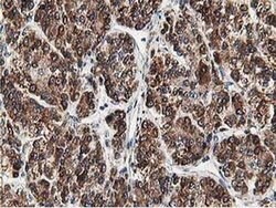 SSR1 Monoclonal Antibody (OTI4H6), TrueMAB , OriGene 100 &mu;L; Unconjugated:Antibodies,
