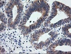 SSR1 Monoclonal Antibody (OTI4C7), TrueMAB , OriGene 30 &mu;L; Unconjugated:Antibodies,
