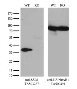 SSR1 Monoclonal Antibody (OTI 4C9), TrueMAB , OriGene 30 &mu;L; Unconjugated:Anticuerpos
