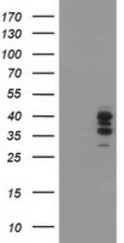 SSR1 Mouse anti-Human, Clone: OTI4H6, lyophilized, TrueMAB 100 &mu;g; Unconjugated:Antibodies,