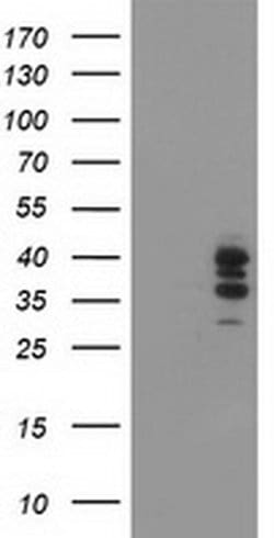 SSR1 Monoclonal Antibody (OTI4H6), TrueMAB , OriGene 100 &mu;L; Unconjugated:Antibodies,