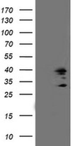 SSR1 Monoclonal Antibody (OTI 5D5), TrueMAB , OriGene 100 &mu;L; Unconjugated:Antibodies,