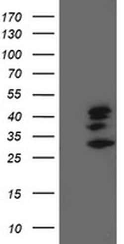 SSR1 Monoclonal Antibody (OTI 4C9), TrueMAB , OriGene 30 &mu;L; Unconjugated:Anticuerpos