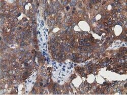 SSSCA1 Mouse anti-Human, Clone: OTI2F5, lyophilized, TrueMAB 100 &mu;g;